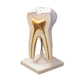 Модель строения зуба