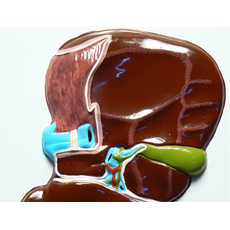 Модель барельефная "Печень" (висцеральная поверхность)