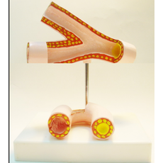 Модель "Здоровые и поврежденные сосуды"