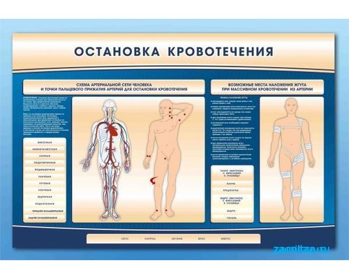 Электрифицированный стенд-тренажер "Остановка кровотечения"