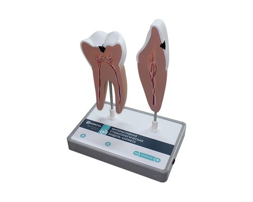 Интерактивная стоматологическая модель кариеса