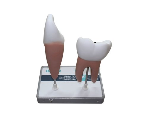 Интерактивная стоматологическая модель кариеса