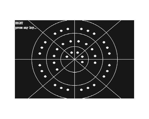 КАПБИС - Программа СКОТОМА