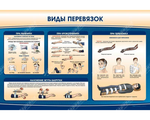 Стенд "Виды перевязок"
