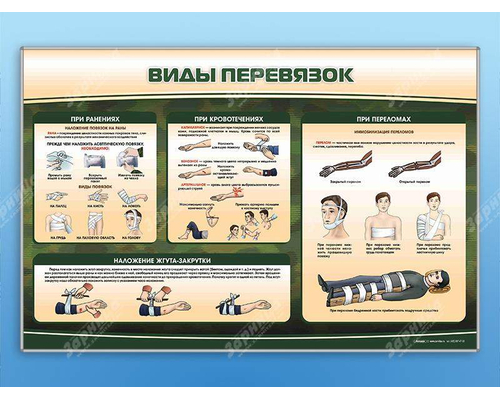Стенд "Виды перевязок"