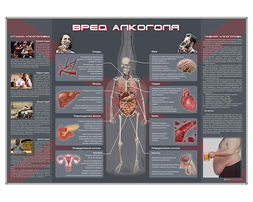 Стенд "Вред алкоголя"
