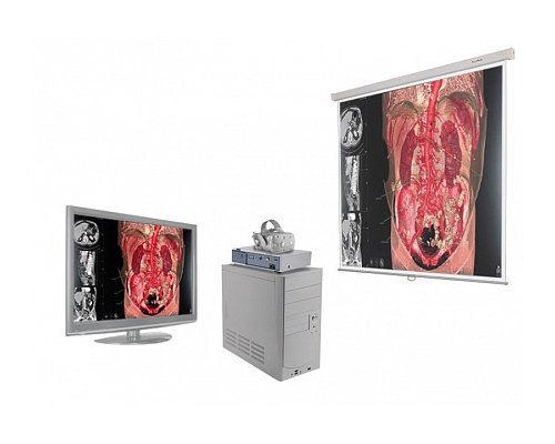 Виртуальный учебный комплекс "Анатомический атлас 4.0"/3